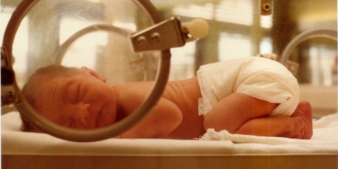 Pertolongan Pertama untuk Bayi Kuning